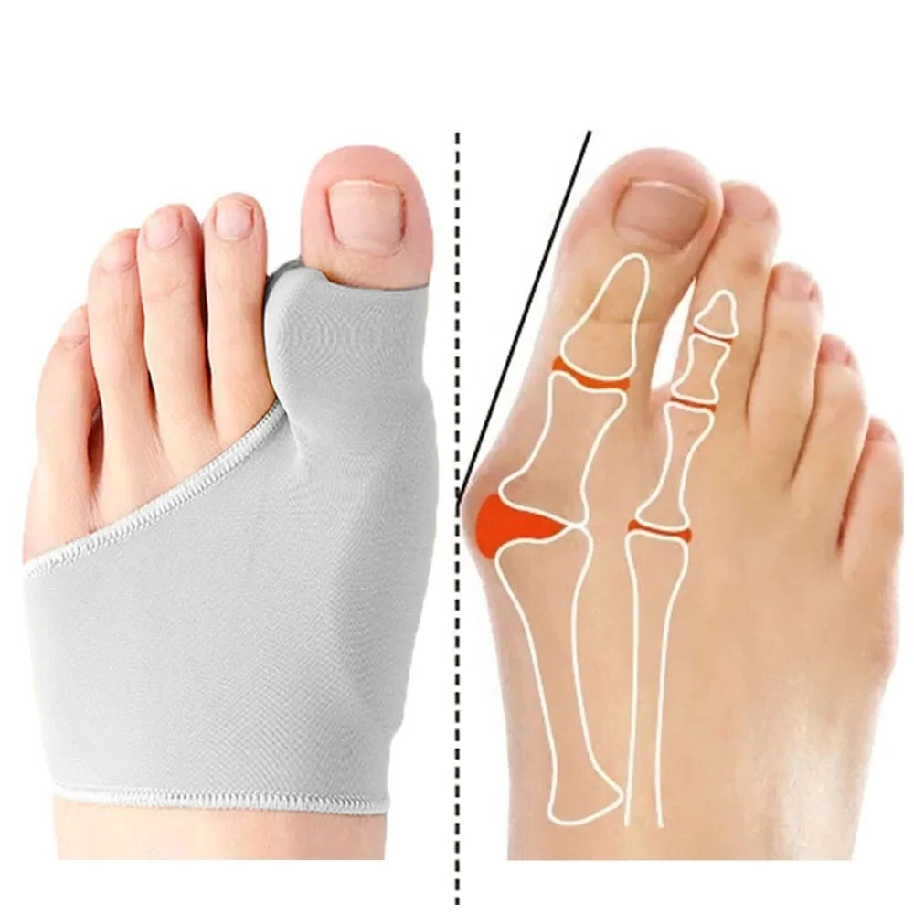 Ankle Brace Sock - 1/2 Paar Teen Separator Hallux Valgus